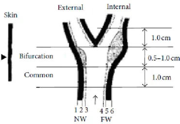 Figure 2: Drawing of the carotid artery with the boundaries: (1) adventitia (NW), (2) adventitia-media (NW), (3) intima-lumen (NW), (4) lumen-initima (FW), (5) media-adventitia(FW) and (6) adventitia (FW)