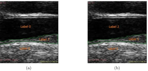 Figure 13: Labels assignment. Green lines indicate the LI-MA region. (a) Case of two labels