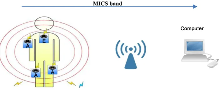 Figure 4. The first scenario. 