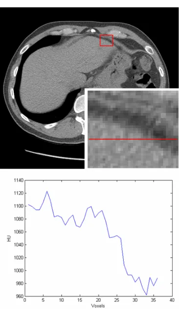 Figure 2: Example of median filtering. 