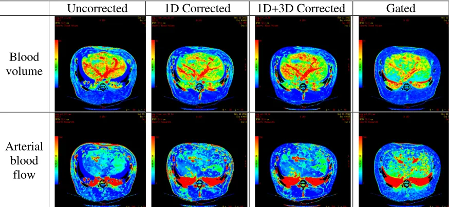 Figure 9: Sample perfusion maps with different motion correction algorithms. 