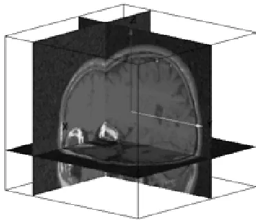 Figure 1: MRI brain image. 
