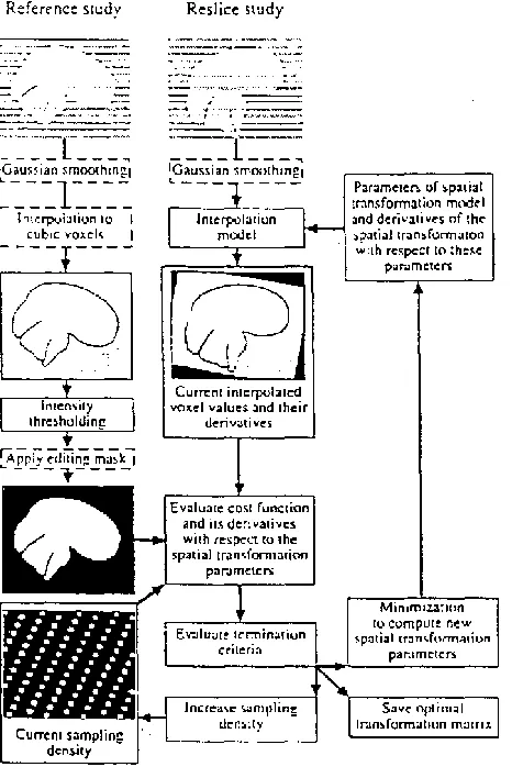 Figure 3: AIR registration algorithm (Woods et al., 1998). 