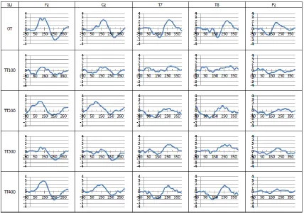 Figure 4b. Grand average of OT and subtracted TT waveforms of group with SLI.  