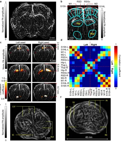 Figure 12. Deep imaging of rat whole brain functions and whole-body anatomy. (a) Rat whole brain vasculature in the coronal plane