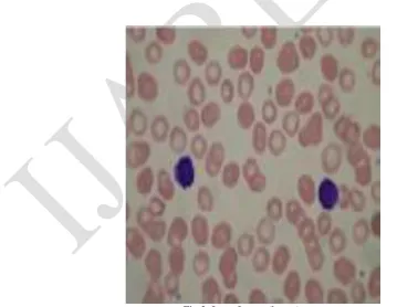 Fig 1.c) Total Cells Count                                                    Fig 1.d)  Execution Time                  