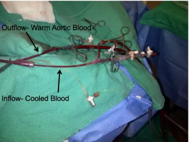 Figure 4 A.  Layout of the access ports for the Outflow and Inflow components of the Duo-Flo catheter 
