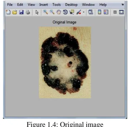 Figure 1.4: Original image In order to fetch the features of the image, 