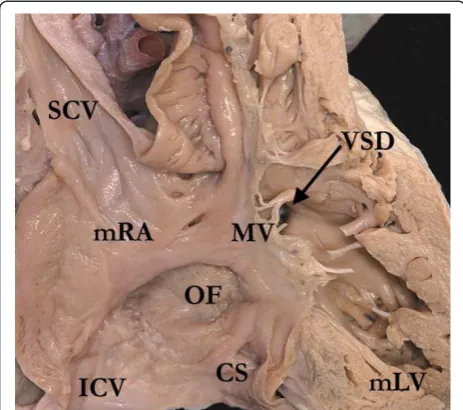 Figure 3 This dissection is made to replicate the parasternallong echocardiographic projection