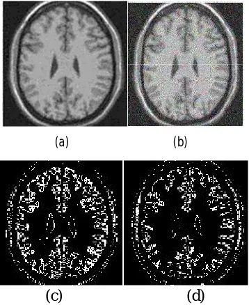 Fig .3Clustering of a brain image (a) original image 