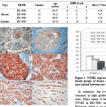 Figure 2. NTSR1 expression (% of high expression) in dif- ferent groups of breast carcinomas