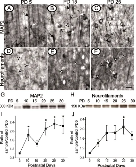 Figure 2. Thalamocortical axons increase complexity while remodeling within the first month of life
