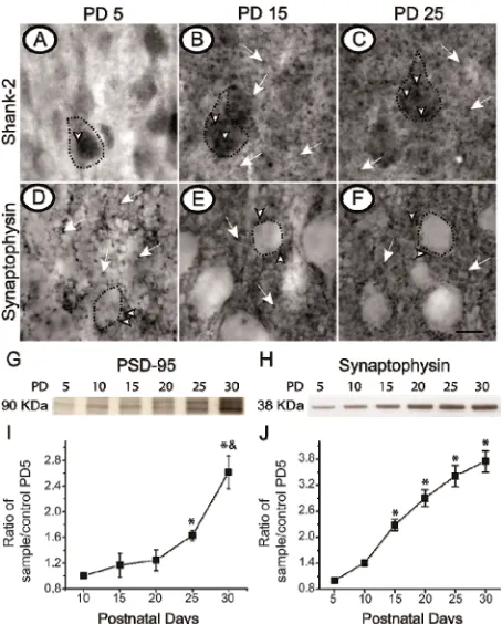 Figure 4Iaptophysin was found surrounding the cell bodies of 