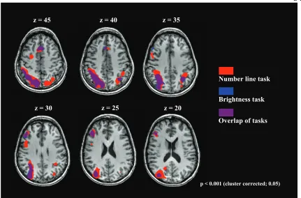 Figure 2.2: Activations of the “Number line task > word control” and the “Brightness task > word control” are displayed in six transversal sections of the brain