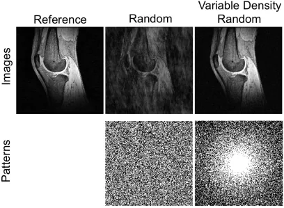 Figure 1.6 Knee Images reconstructed using random and variable density random 