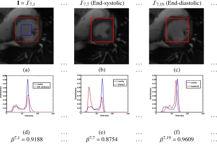 Figure 2.4: Computing image statistics for the frames of slice 7 (middle slice): (a) referenceimage (red curve:sures (diastolic); (d), (e), and (f) the corresponding intensity distributions and Bhattacharyya mea- Γout, blue curve: Γin); (b): frame 7 (end-s