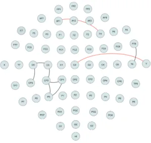 Figure 4: Black lines denote edges identified only by the alcoholic group and red lines denote edges identified only by the control group.