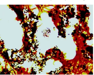 Fig 4.    A Warthin-Starry stain showed numerous bacilli. Some are arranged in clumps