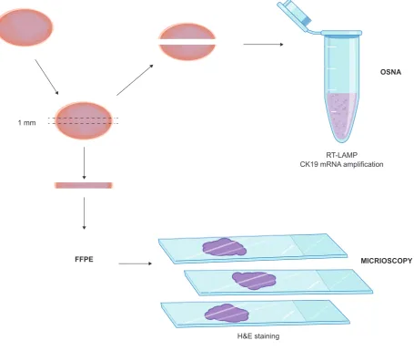 Figure 1 – Lymph node procedure and assessment