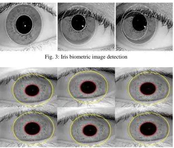 Fig. 3: Iris biometric image detection 