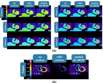 Fig. 5  (a) Noise-free reconstructed dynamic PET and (b) sPatlak �� images, corresponding to the cardiac bed and to time frames of our validated clinical WB dynamic PET protocol