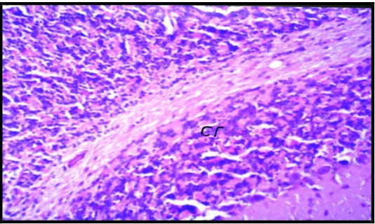 Fig. 4: Showing normal histological structure of                         Fig. 5: Showing normal histological structure             meninges (m), cerebral cortex (cc) and                                  of striatum (cs) and hippocampus (hp) of negative    