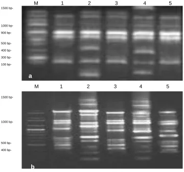 Figure (2): Expression of SOD mRNA in brain tissues of male rats treated with PTU and LT4 and analyzed by the semi-quantitative Real Time-PCR