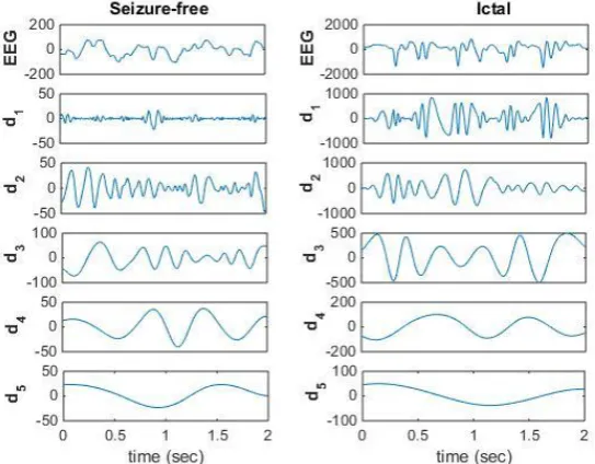 Figure 2:  Sample EEG epoch from each set (A – E)   