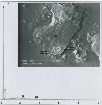 Figure 3. Above: SEM1 (in GSE) photograph (7500×) of the b1 particle (P: “poil”). Below: b1 spectrum at the black point indicated, located in an area appearing devoided in mineral deposits