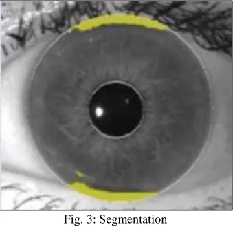 Fig. 4: Normalization 