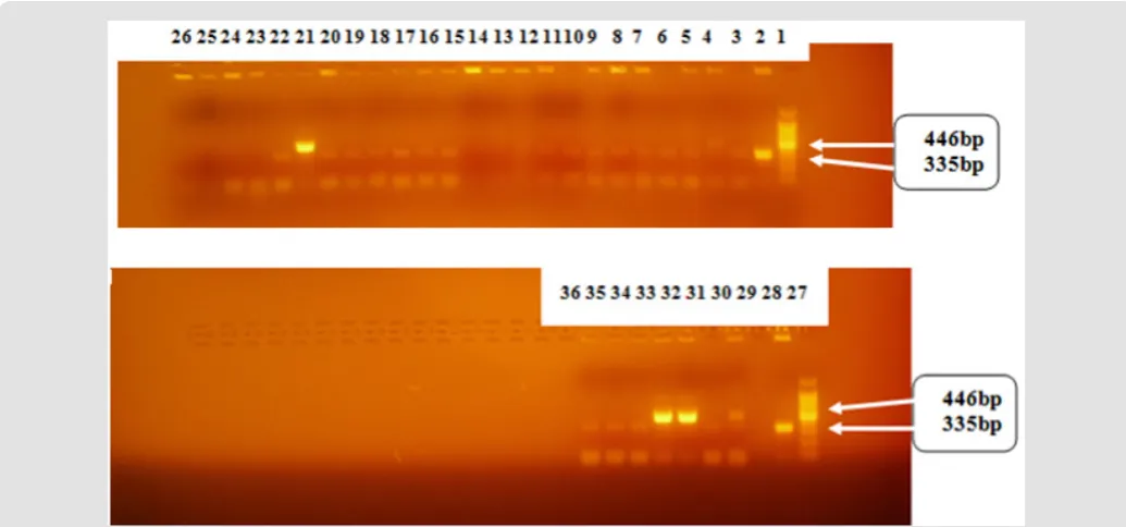 Figure 6: Spoligotype patterns of M. bovis isolates from TB lesions of cattle from Hawassa abattoirs