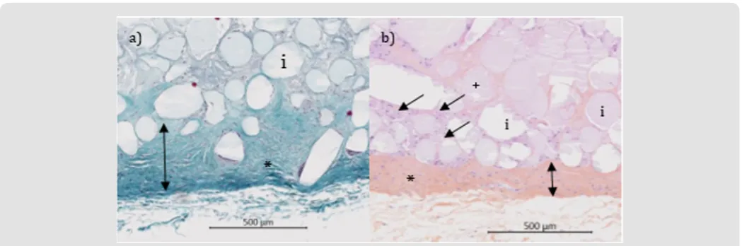 Figure 2: Histological micrographs of FP sites at 26 weeks (Masson trichrome stain). 