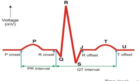 Fig.  1   An ECG waveform 