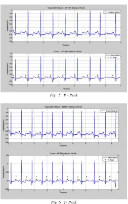 Fig.  5   P - Peak 