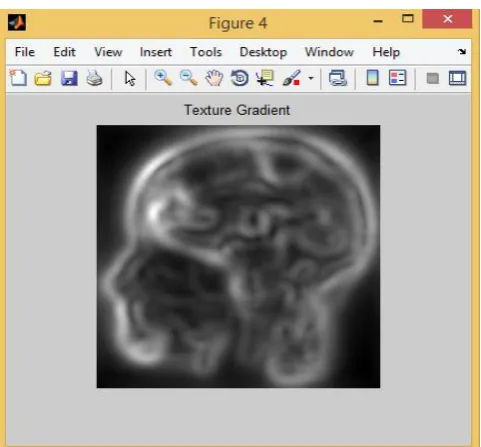 Figure 4: MRI Image output using modulated intensity gradient based segmentation.   