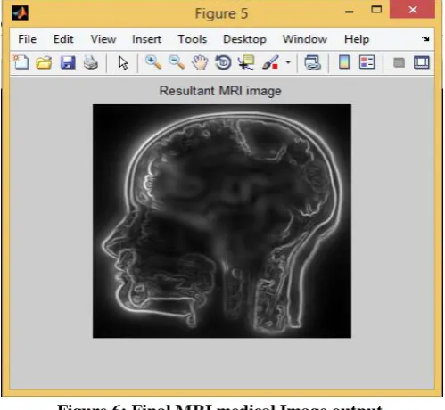 Figure 6: Final MRI medical Image output.  