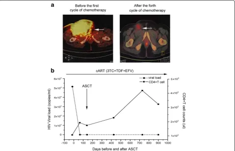 Fig. 1 abone marrow transplantation. Continuous lines show the viral load and CD4+ T cell counts measured using a standard clinical test before andafter autologous stem cell transplantation