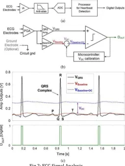 Fig 2: ECG Signal Analysis Noise Reduction and ECG Feature Extraction 