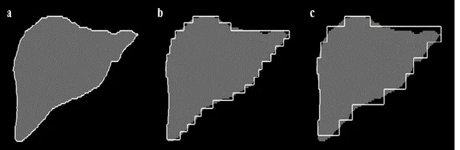 Table – 1 The Evaluation of a Non-Expert Manual Liver Contouring using Ground-Truth Segmentation 