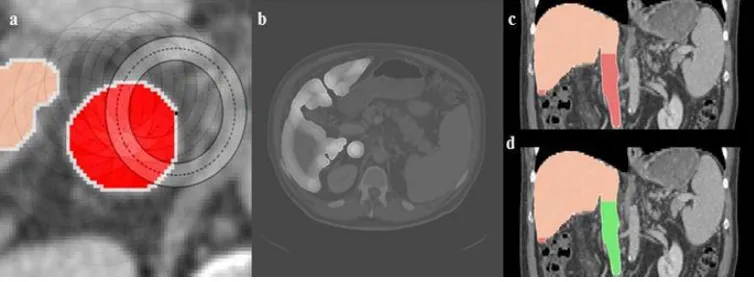 Fig. 2: Segmentation using neighbour-connected region-growing: initial region (a), result of the segmentation (b) and the subsequent dilation  (c)
