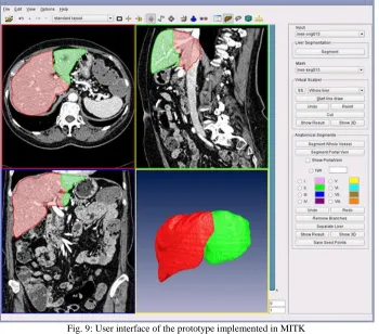 Fig. 9: User interface of the prototype implemented in MITK 