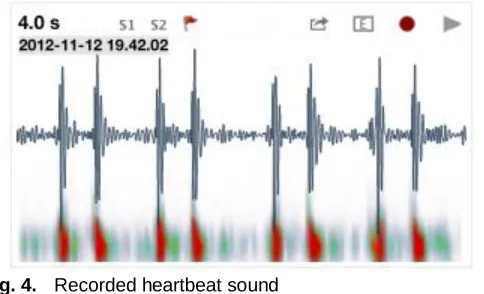 Fig. 4. Recorded heartbeat sound  