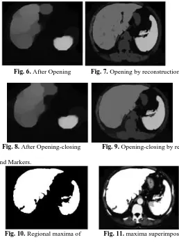 Fig. 9.  Opening-closing by reconstruction 