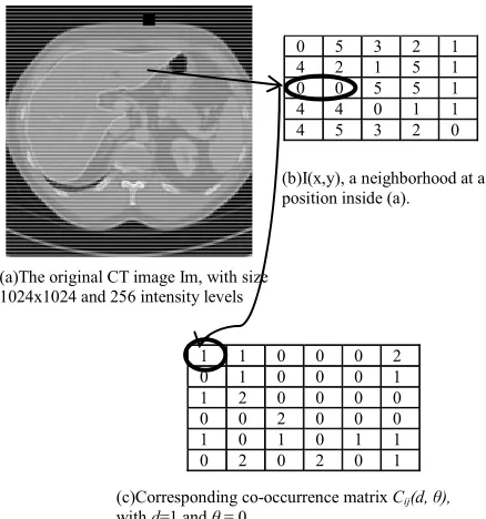 Figure 2 illustrates the calculation of sake of easy description, the maximal intensity value is supposed to be 5, much less than that of original liver CT image