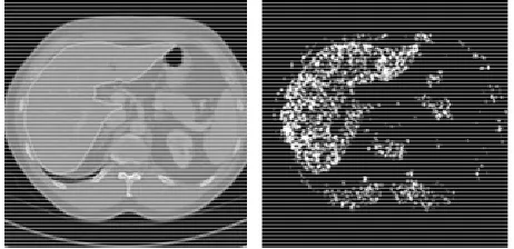 Figure 4. An example of liver distribution image leftoriginal image; : an right: output of SVMs