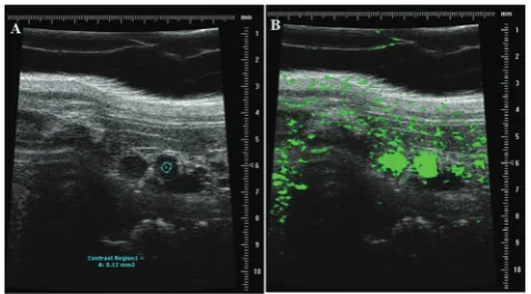 Fig. 2In vivo(A) A region of interest (ROI) within the aorta was selected for post-processinganalysis (blue region) to determine the contrast intensity within the aorta over imaging of mouse aorta with high frequency ultrasound.time