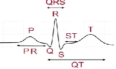 Figure 2. Graph of a virtual ECG signal and characteristic points 