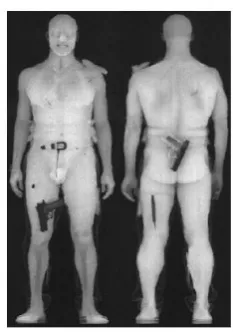 Figure 7.  Low-dose X-ray scan results [3] 