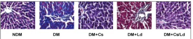 Fig. 3. The effect of C. sativa and L. deterrimus and their combination on the distribution between cytosol and nuclear fraction of Akt, pAkt, STAT3 and C/EBPβ in the liver of diabetic rats four weeks after administration of the last dose of STZ