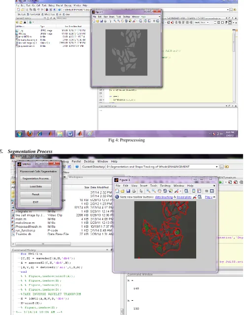 Fig 4: Preprocessing 